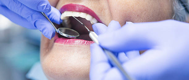 Best Emergency Root Canal Treatment in Orangeville, UT